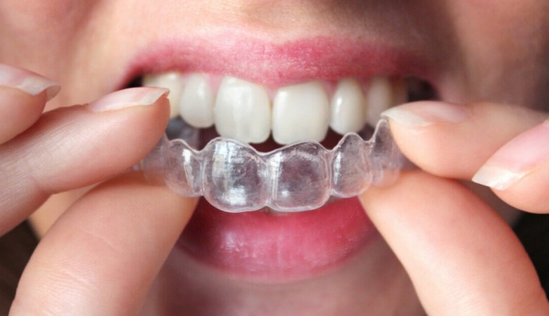 Taş Devrinden Kalan Diş Plakları Kayıp Mikropları Ortaya Çıkarıyor