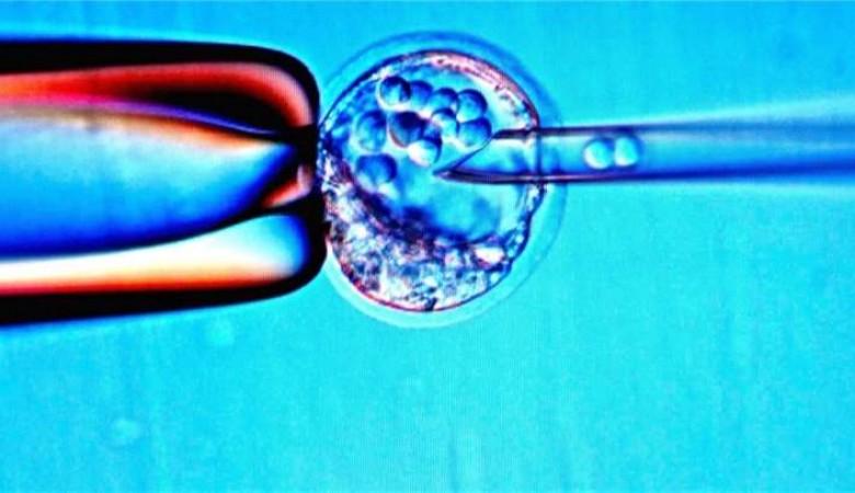 Japonya'da İlk Kez IPS Kök Hücreler Kalp Ameliyatında Kullanıldı