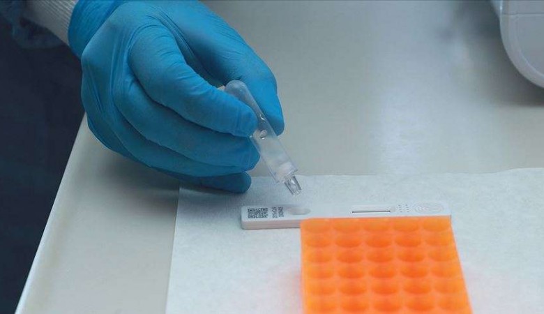 Koronavirüs Tanı Laboratuvarları Hızla Yaygınlaştırılıyor